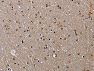 MED12 Antibody