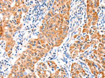 VANGL1 Antibody
