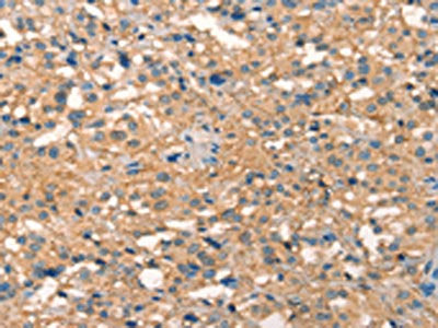 PICK1 Antibody