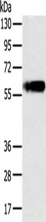 PLIN1 Antibody