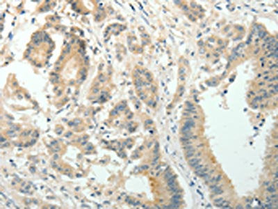 SIRT3 Antibody