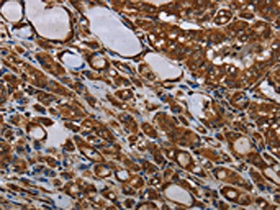 MT-ND1 Antibody