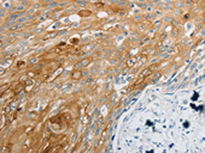 EDNRB Antibody