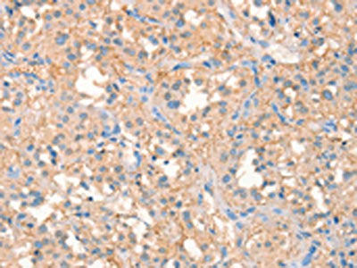 KCNB1 Antibody