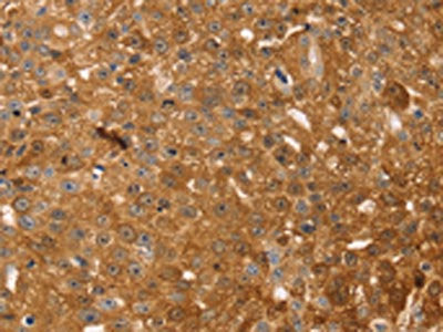 TMSB10 Antibody