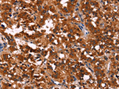 RPSA Antibody