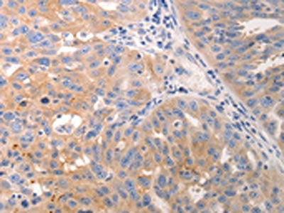 KRT6A/KRT6B/KRT6C Antibody