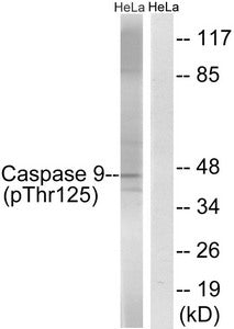 Phospho-CASP9 (Thr125) Antibody
