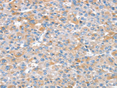 SNX25 Antibody
