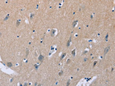 LIFR Antibody