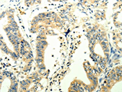 TRPM7 Antibody