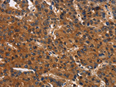 CEACAM1 Antibody
