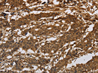 ITGB7 Antibody