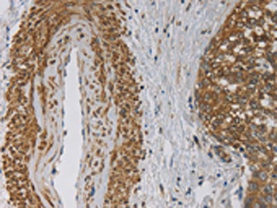 EMC8 Antibody
