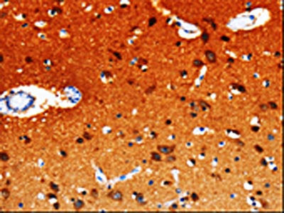 GDI1 Antibody