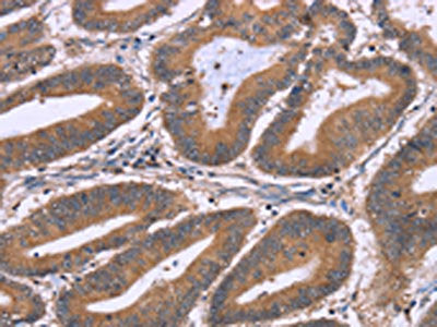NRG1 Antibody