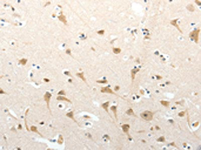 SEMA3D Antibody