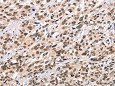 CCNT1 Antibody