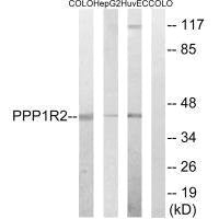 PPP1R2 (Ab-44) Antibody