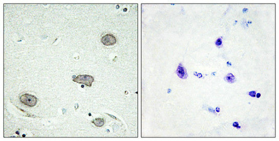 Phospho-CSF1R (Tyr809) Antibody