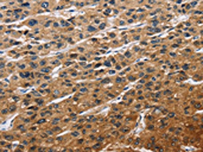EIF4EBP2 Antibody