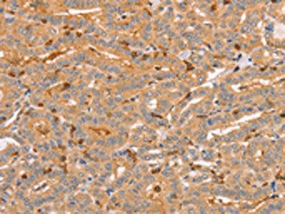 CCL16 Antibody