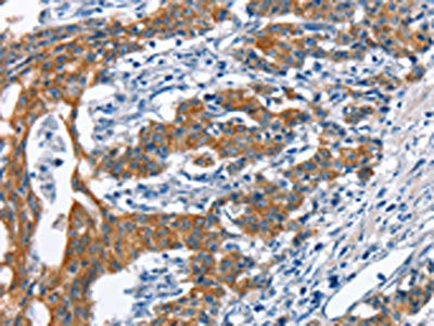 MMP2 Antibody