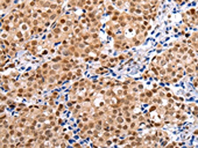 BRMS1 Antibody