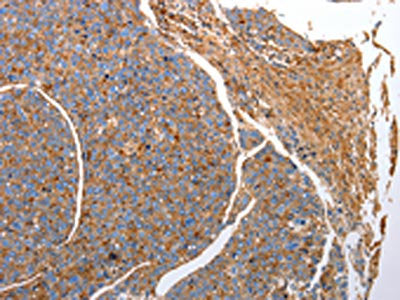 CD151 Antibody