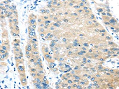 VPS4A Antibody