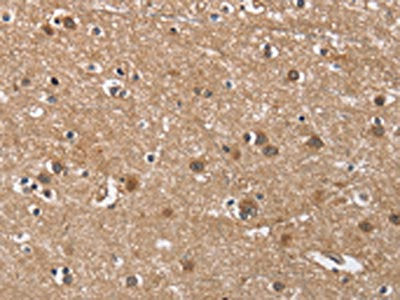 BUB1 Antibody