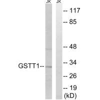 GSTT1/GSTT4 Antibody