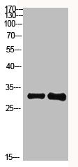 KCTD7 Antibody
