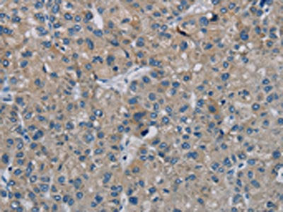 PHKG2 Antibody