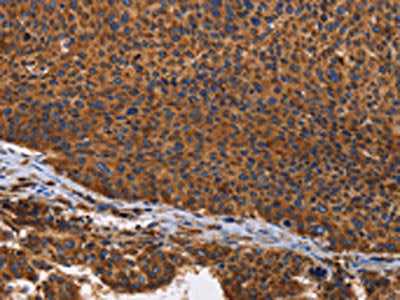 ILK Antibody