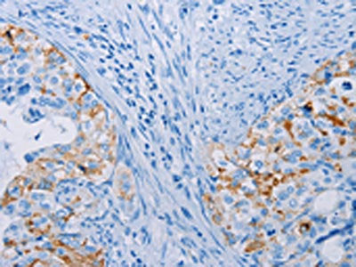 CA10 Antibody