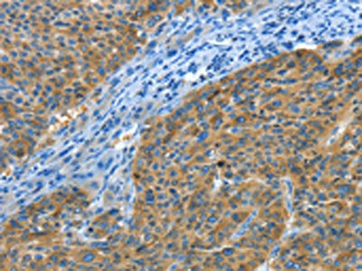 BIN1 Antibody