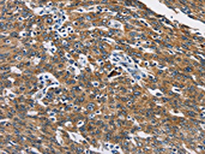 CAT Antibody