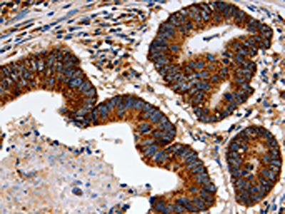 TRAP1 Antibody