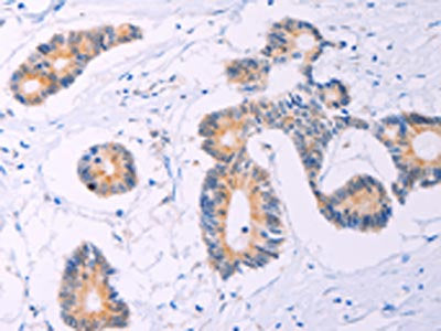 ADCY5 Antibody