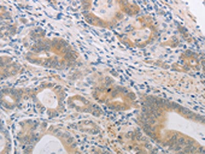 PGA3/PGA4/PGA5 Antibody