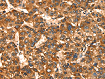 CACNA1E Antibody