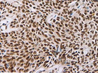 AKAP8 Antibody
