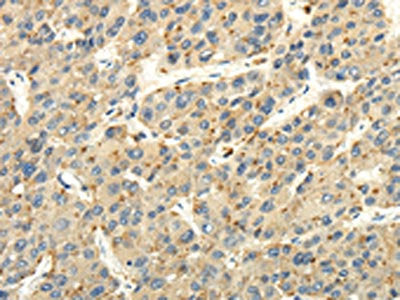STRA6 Antibody