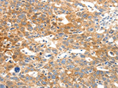 SCN5A Antibody