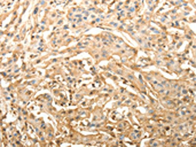 SLC25A11 Antibody