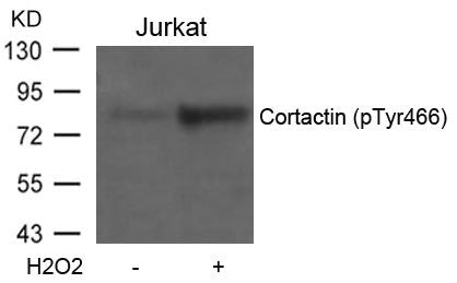 Phospho-CTTN (Tyr466) Antibody