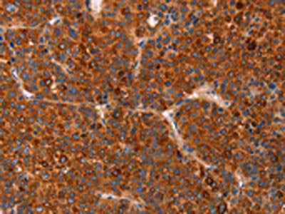 GC Antibody