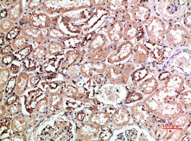 KIR2DL5A/KIR2DL5B Antibody