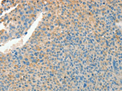 CHRDL2 Antibody